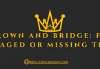 crown and bridge​
